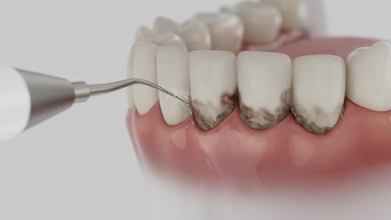 Reliable Dental Implants contractor in Eustace, TX by Smile Center Dentistry